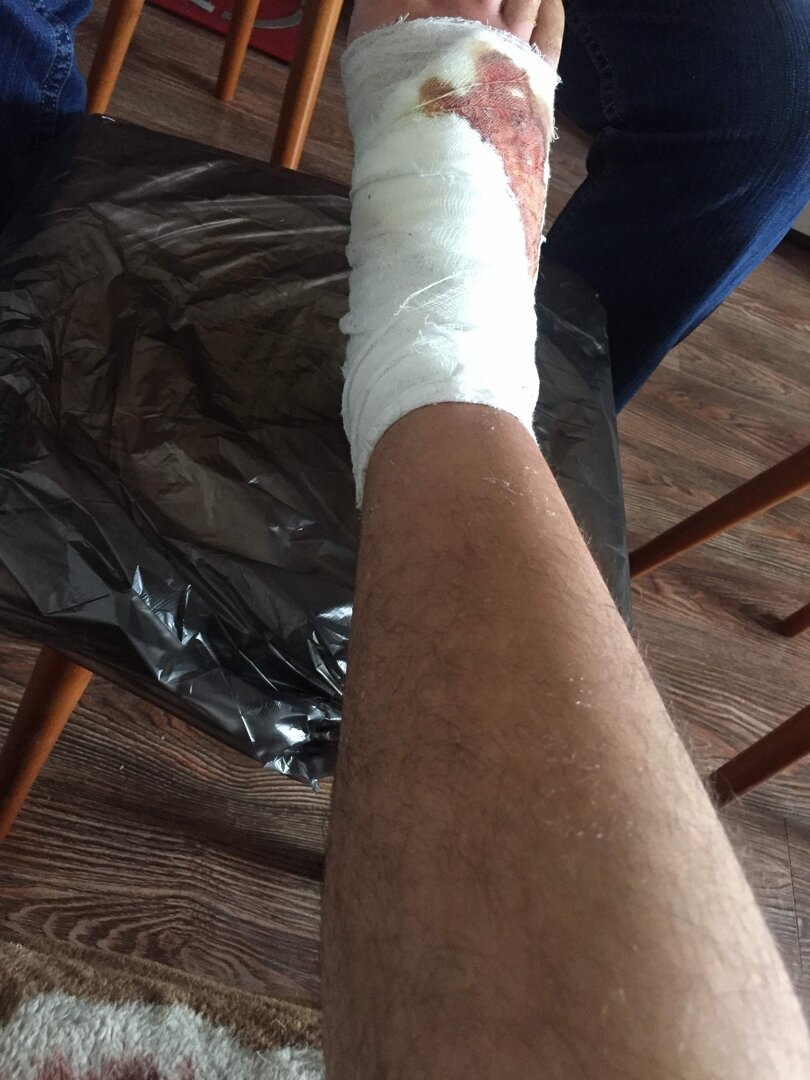 Папа меняет повязку