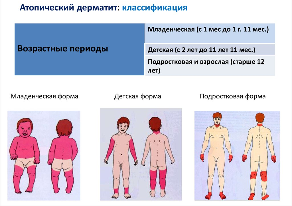 Грибковая аллергия: причины возникновения, симптомы и методы лечения #аллергия@a