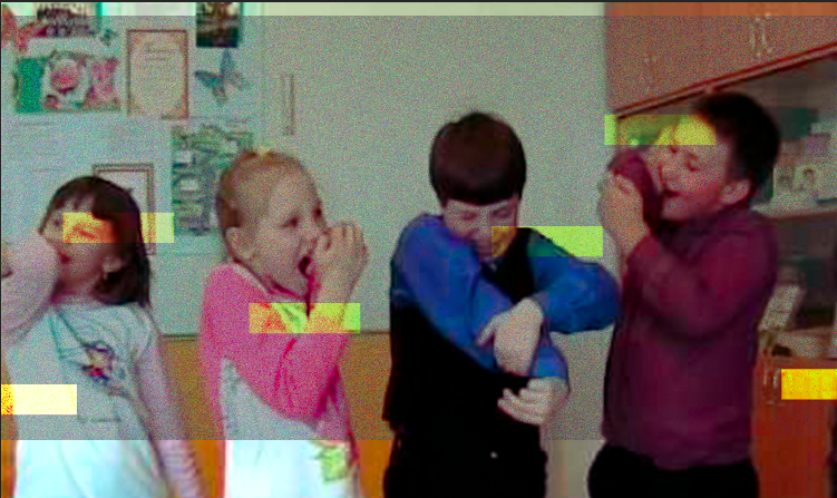 Локти, короче. 