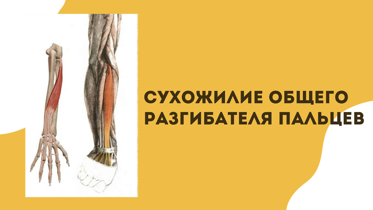 Теннисный локоть