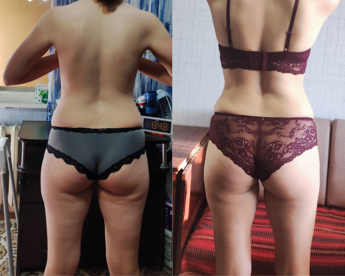 Фото слева - начало лета. Я уже прилично похудевшая, но с дряблыми ногами и складкой под ягодицами, позади массажи и скрабы. Фото справа - сейчас, практически полное отсутвие косметических процедур, акцент на питании и тренировках 