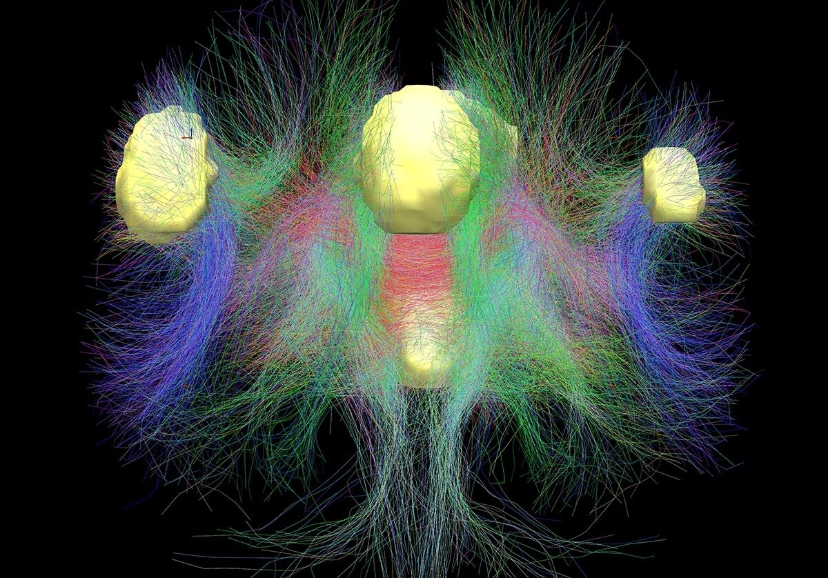 Нейронная сеть