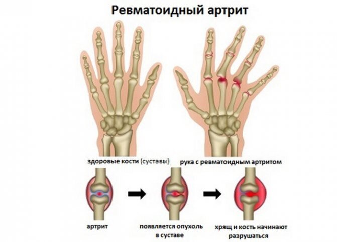 Изображение взято из Яндекс.Картинки