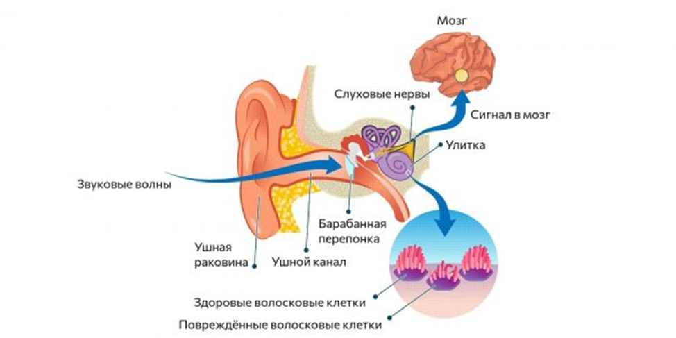 Пульсирующий звук в ухе. Тиннитус низкочастотный. Заболевание тиннитус что это. Тиннитус причины.