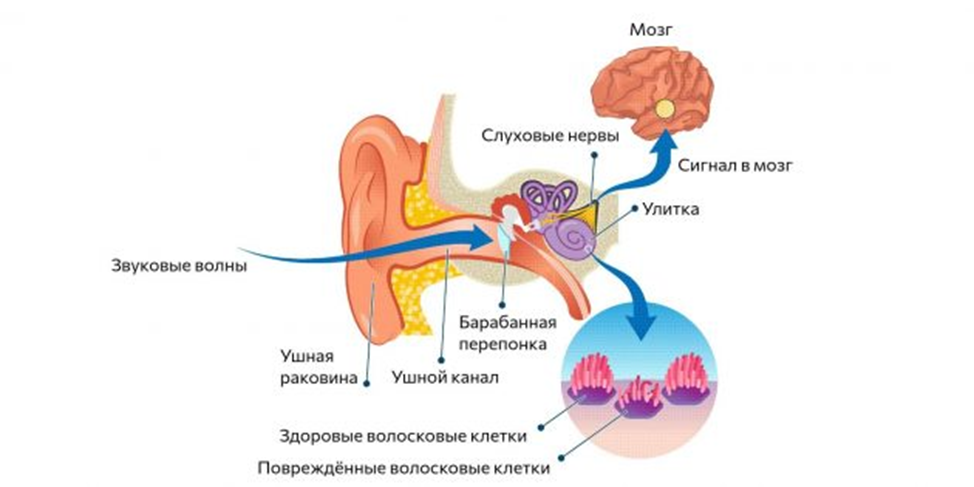 Что такое пульсирующий шум в ухе. Тиннитус шум в ушах. тиннитус это заболевание.