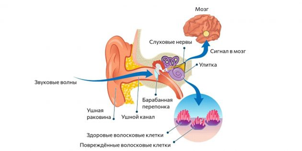 Лечение тиннитуса