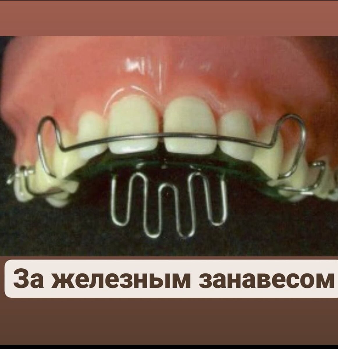 Пластинка с заслоном для языка ортодонтия
