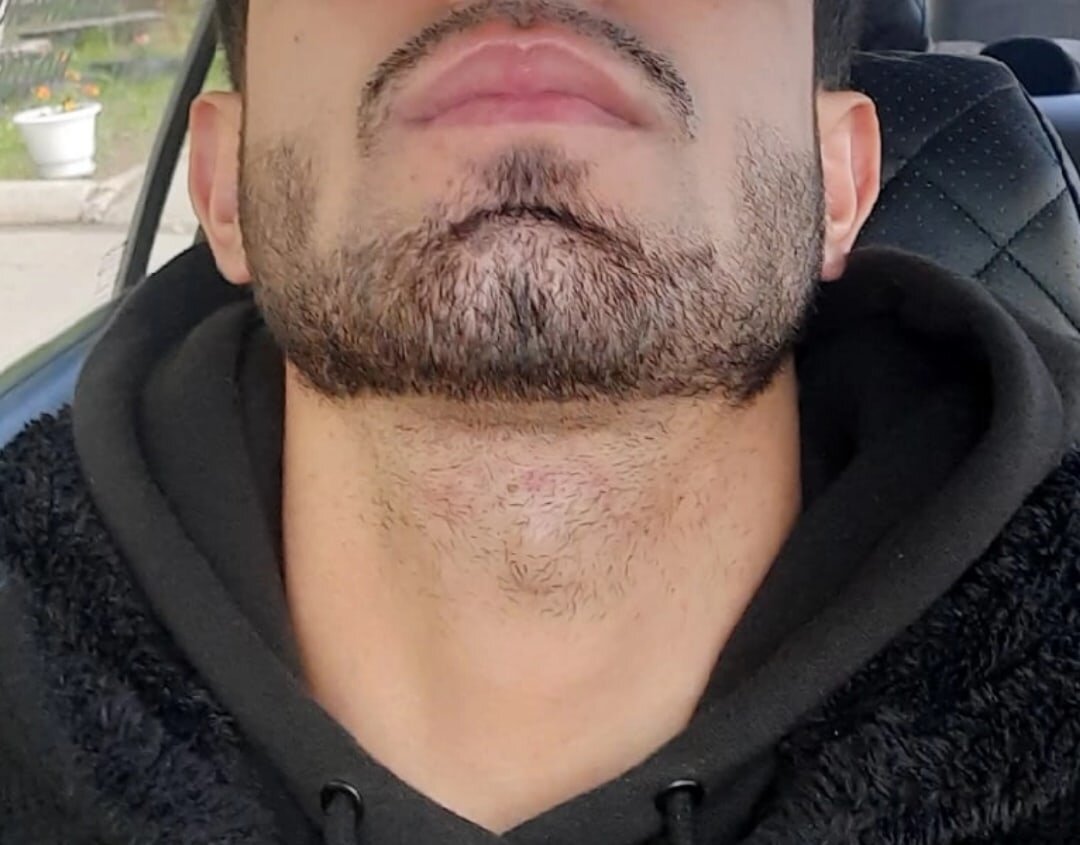 -2