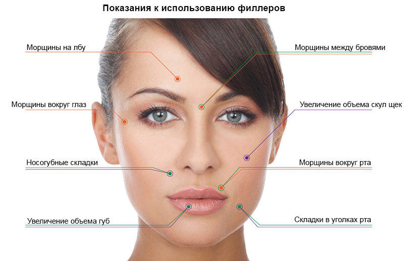 Контурная пластика губ: всё о процедуре