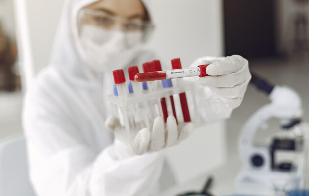 Сейчас в Украине действует адаптивный карантин© depositphotos / prostooleh
Украина находится на пятом месте в Европе по количеству новых случаев заражения коронавирусом в сутки. Об этом свидетельствуют данные Worldometer, который отслеживает ситуацию с распространением болезни.Также мы находимся на 25 позиции в мире по общему количеству инфицированных с начала пандемии.За последние 24 часа больше новых случаев коронавирусной болезни зафиксировали во Франции, России, Испании и Великобритании.В этом же рейтинге по всему миру, а не только по Европе, Украина находится на 15 позиции.Читайте так же: В мире более 30 млн случаев заражения коронавирусом: карта
Напомним, правительство изменило критерии эпидемической опасности "красной" зоны. Также в "оранжевой" зоне Кабмин решил изменить карантинные ограничения. Такое решение Кабинет министров принял во время заседания 16 сентября с доработкой в один день.На сегодняшний день COVID-19 уже унес более трех тысяч украинских жизней. Количество больных ежедневно растет. Согласно прогнозам, ожидать улучшения ситуации до весны нам вряд ли стоит. Тема лечения коронавируса в Украине обсуждается в интервью Аллы Котляр с президентом "Биофармы" Константином Ефименко: "Даже применение стандартного иммуноглобулина без специфических к ковид антител увеличивает шансы на выздоровление в разы".