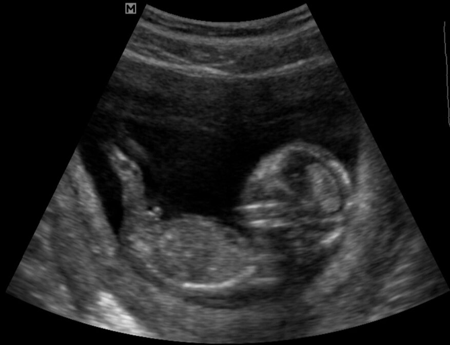 Недовольно упирается ножками