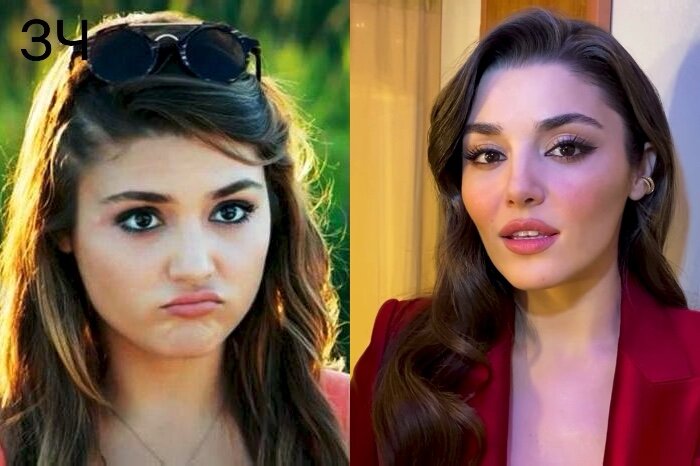 ханде эрчел пластическая операция делали. ханде эрчел до пластики. ханде эрчел до пластики. актриса ханде эрчел комки биша. ханде эрчел пластика.