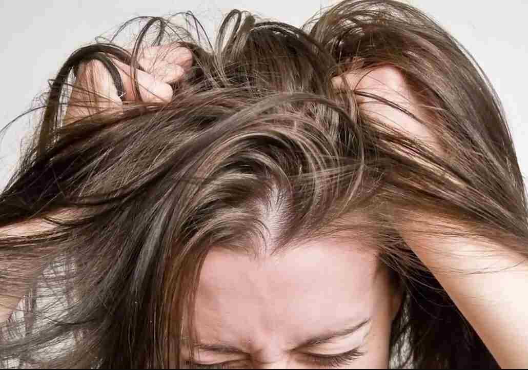 Вечно сальные волосы, мучает зуд кожи головы?! | CosmeticBrand.ru | Дзен