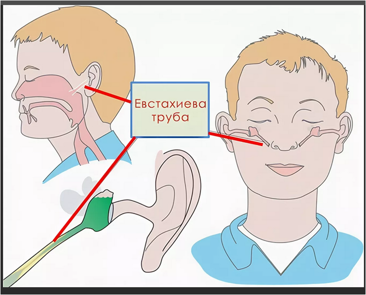 Заложило уши что делать отзывы. Слуховая (евстахиева) труба соединяет. Строение евстахиевой трубы и носа.