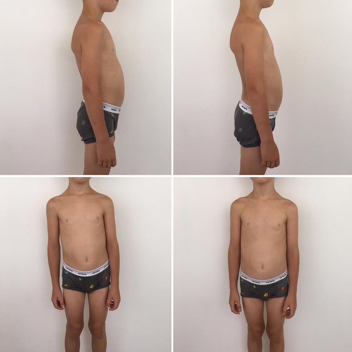 На фото результат 2-х сеансов 