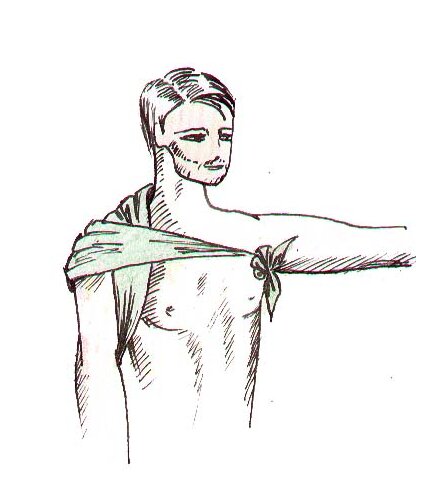 Повязка надплечья «галстуком». На область надплечья и подмышечной впадины косыночною повязку накладывают в виде галстука, складывая ее в несколько слоев. Галстук после перекреста над плечом проводят вокруг груди и завязывают в подмышечной области противоположной стороны.                                                                                             