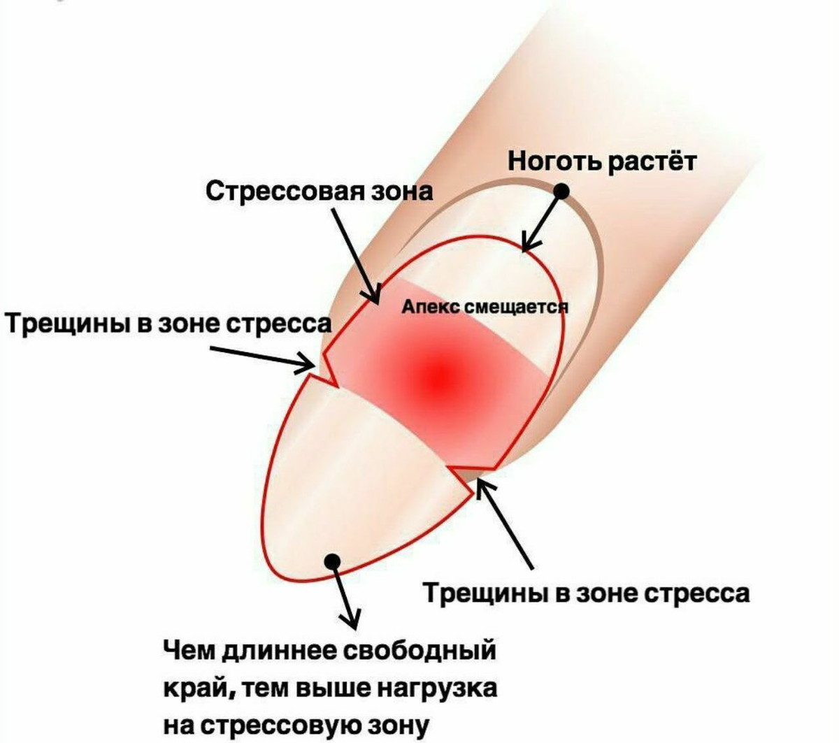 Гель лаком ногтевой пластины. Выравнивание ногтевой пластины схема. Стрессовая зона ногтя схема. Зона стресса на ногте. Строение ногтя.