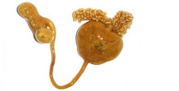 Так выглядит Сфирион Люмпи (копепода)