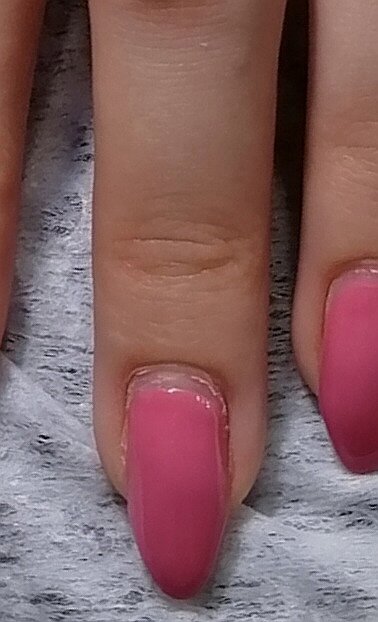 Кутикула через 3 недели после среза аппаратом, её размер 1 мм.