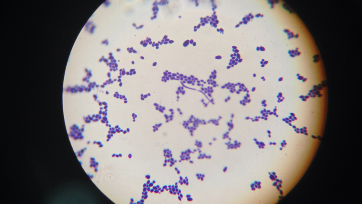 Yogurt Monsters - Cloudy Days & Microscopes - Cloudy Nights
