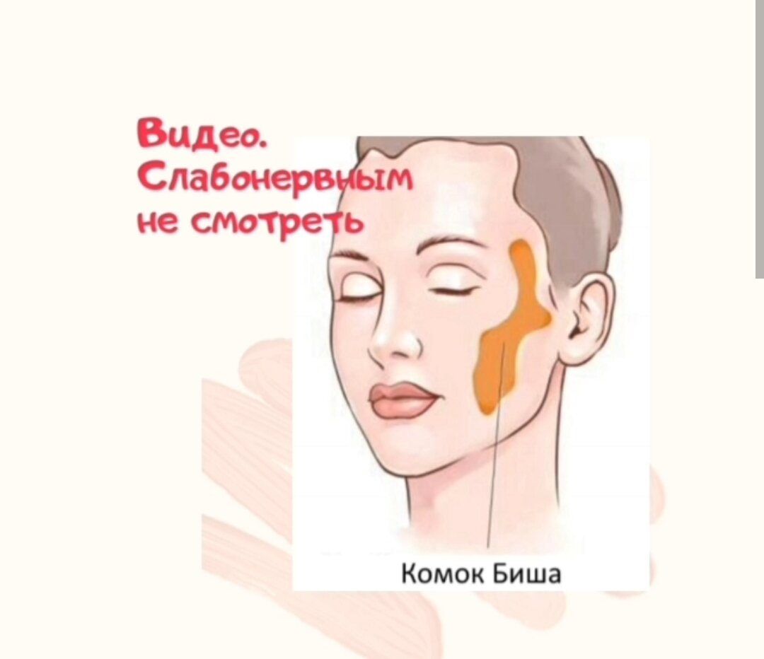 комки биша на схеме лица