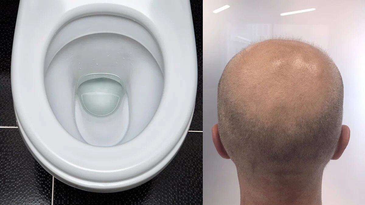 Унитаз блестит