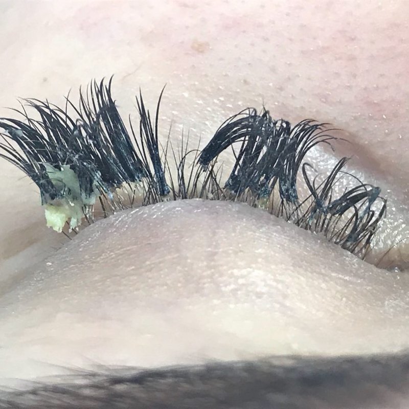 Сегодня расскажу вам об одном из страшнейших косяков рукожопого мастера по наращиванию ресниц.