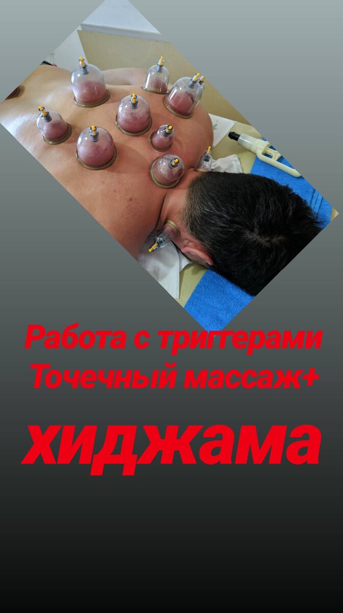 Триггерные точки или курковые зоны – что это такое?
Многие слышали о так называемых активных точках на теле человека. Акупунктура, или рефлекторный массаж точек, является одним из традиционных восточных методов лечения. Однако мало кому известно о том, что понятие о триггерных точках существует и в обычной классической медицине. Вот только триггерные точки и активные точки в восточной медицине – далеко не одно и то же.

Теория триггерных точек была разработана американскими врачами Д. Симмонсом, Дж. Тревеллом, Л. Джонсом в семидесятых годах XX века. Триггер – в переводе с английского «курок», «спусковой механизм». Значение триггерных точек в медицине трудно переоценить. Сегодня эти знания нашли применение в физиотерапии и массаже при патологии опорно-двигательной системы. В методиках восточной медицины точки используются в качестве своеобразных каналов циркуляции жизненной энергии в организме человека. А в соответствии с постулатами теории триггерных точек существуют пусковые точки боли, или, как их еще называют – триггерные точки на нашем теле, прицельное воздействие на которые позволяет снимать боль в том или ином отделе позвоночника, в области головы, в конечностях и даже во внутренних органах.

Особенность этих точек состоит в том, что они способны поддерживать болевые ощущения не там, где расположены, а в другом участке тела, согласно пути распространения нервных сигналов. Например, головные боли бывают связаны с триггерными точкам в мышцах шеи, боль в руке 