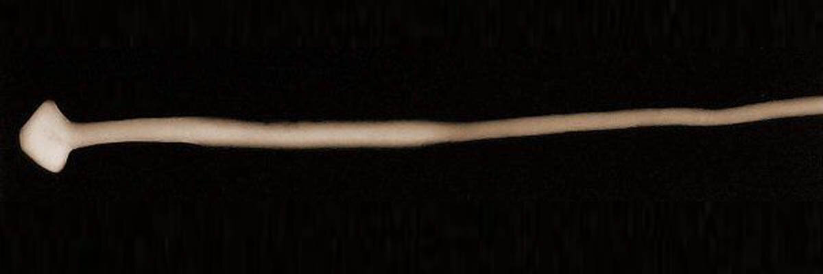 Рентгеновский снимок иглы Туровича