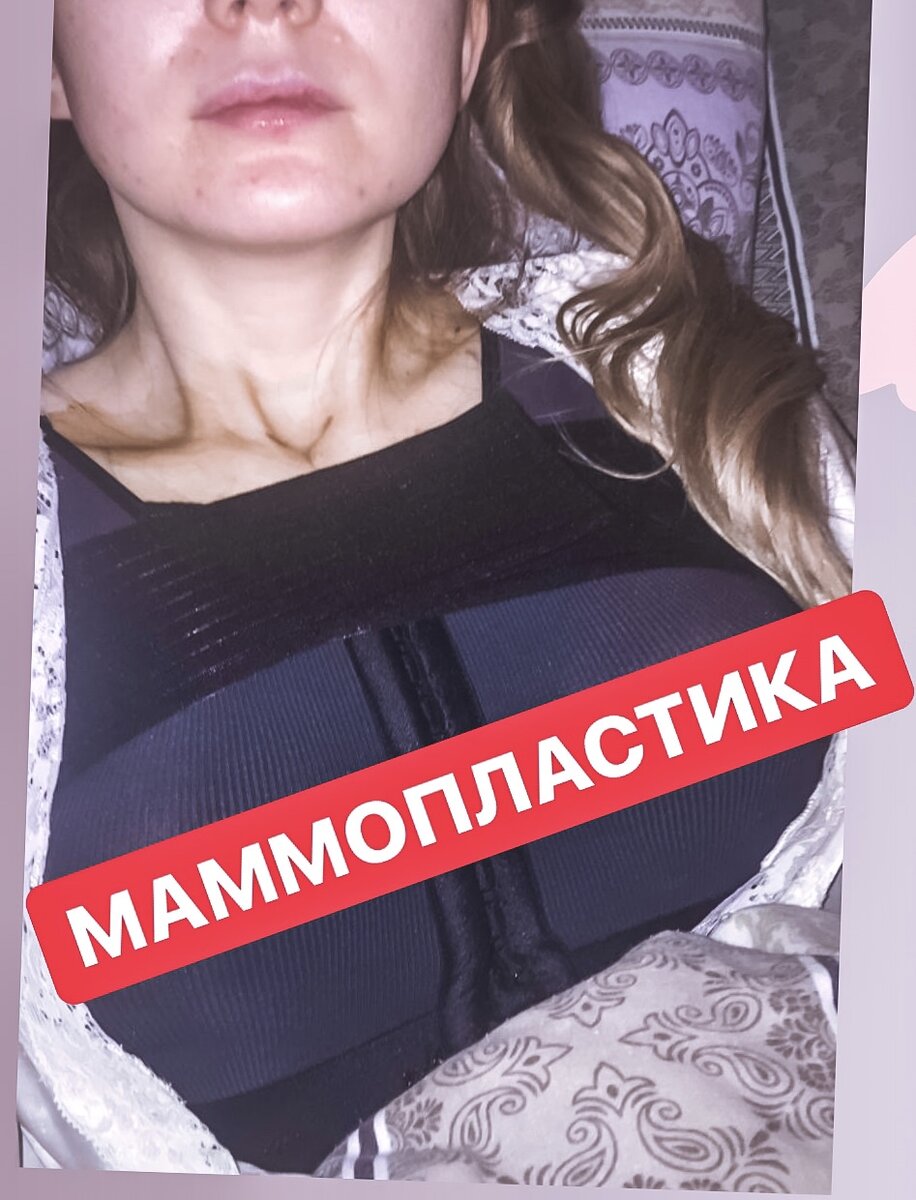Сразу после операции