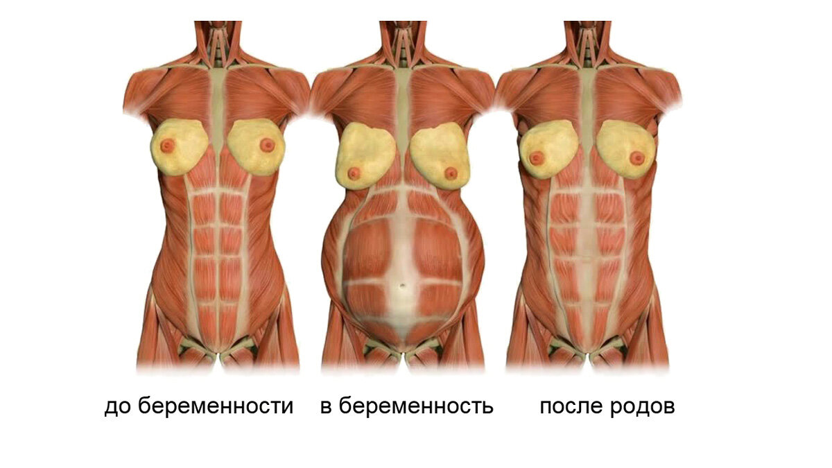 Горизонтальные линии живота