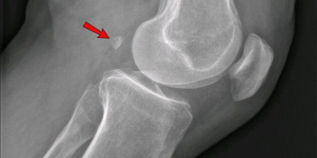 Человек, Тело, Интересное, Наука, Организм, Анатомия 