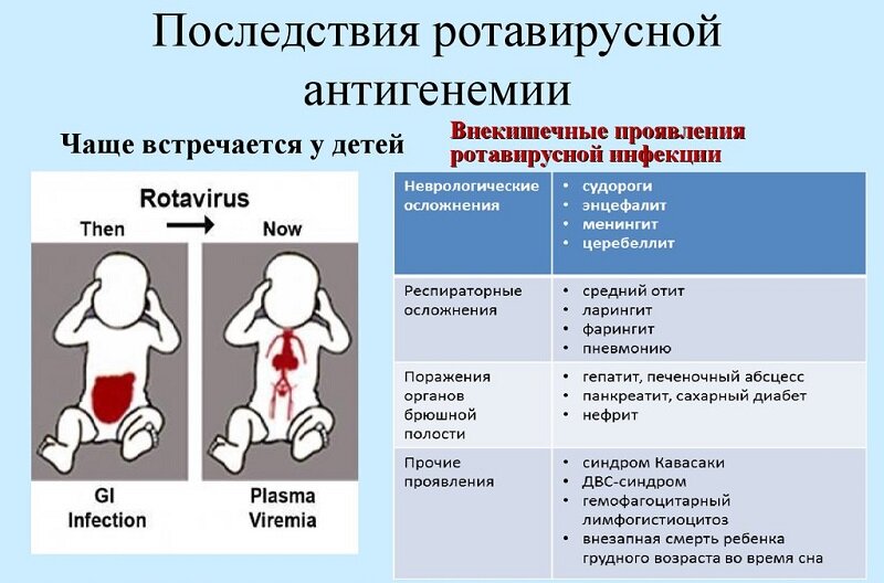 Ротавирусная кишечная инфекция у взрослых: симптомы, лечение