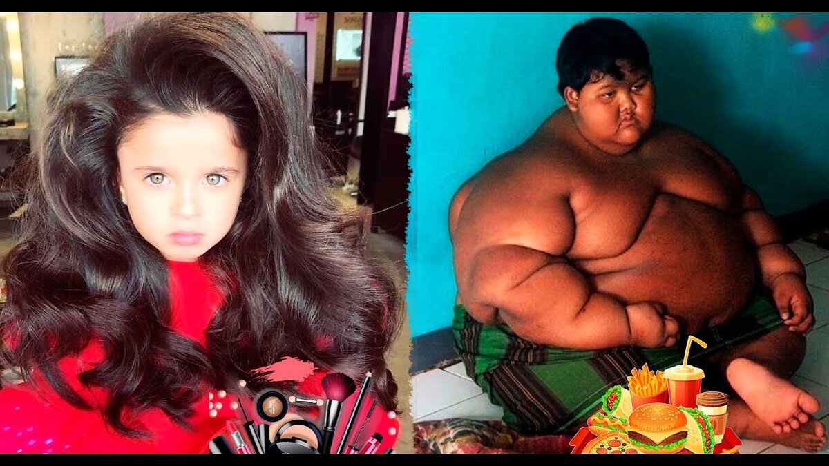 Обложка виде на Яндекс.Эфир, Слева Мия Афлало, а справа - самый толстый мальчик в мире - сейчас он значительно похудел 