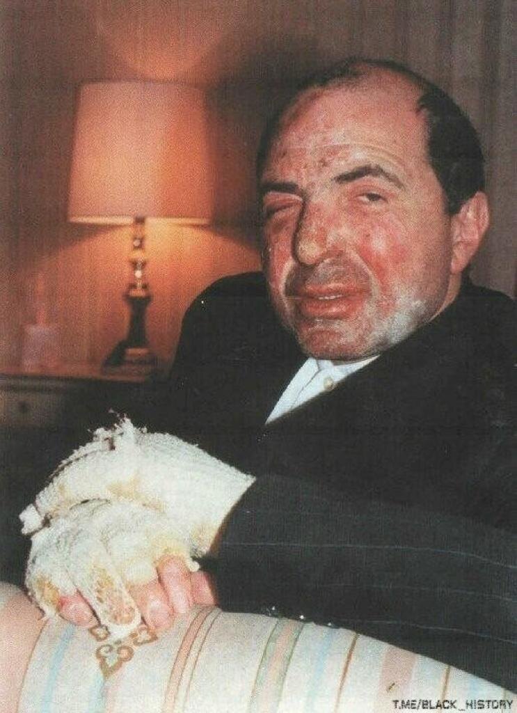 Борис Березовский после покушения, 1994 год.  7 июня 1994 года возле дома № 40 по Новокузнецкой улице в центре Москвы, где располагался дом приёмов «Логоваза», в момент, когда «Мерседес» представительского класса с находившимся внутри Березовским выезжал из ворот дома приёмов, было приведено в действие взрывное устройство. В результате взрыва погиб водитель автомобиля, ранены охранник и 8 случайных прохожих. По версии следствия, организатором преступления выступил известный московский криминальный авторитет, лидер Ореховской преступной группировки Сергей Тимофеев по прозвищу «Сильвестр», который в сентябре того же года был взорван в своём автомобиле на 3-й Тверской-Ямской улице. Убийство Тимофеева осталось нераскрытым.