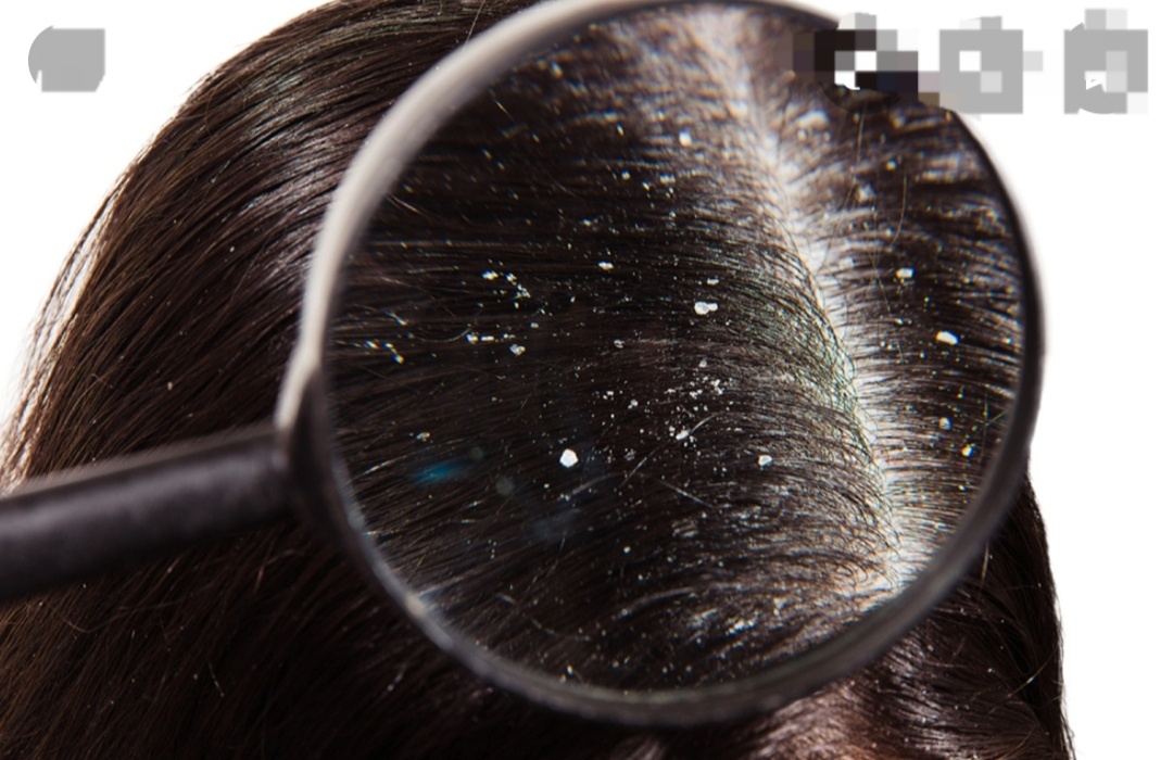 Очень не приятная штука)