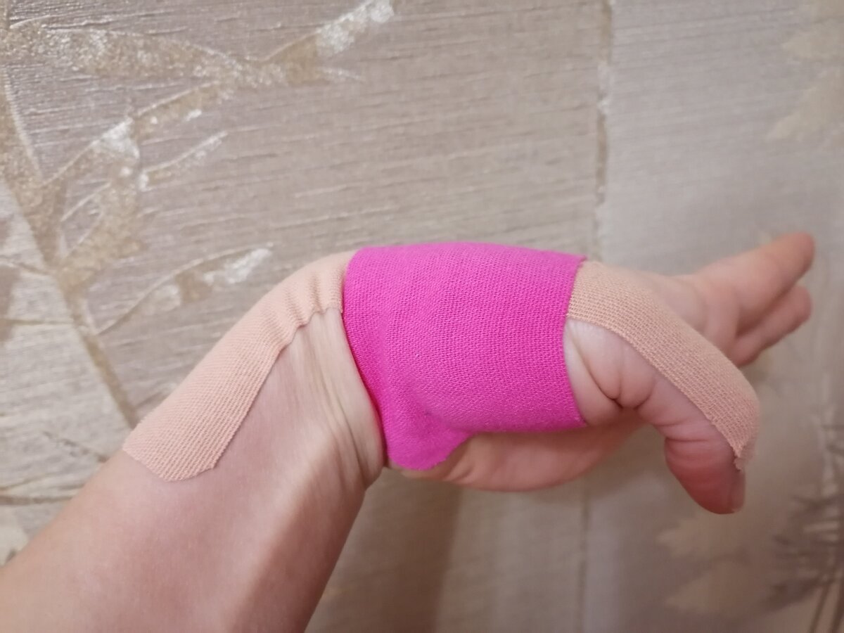 Вот в таком  положении  кисти  наклеивать  без натяжения  