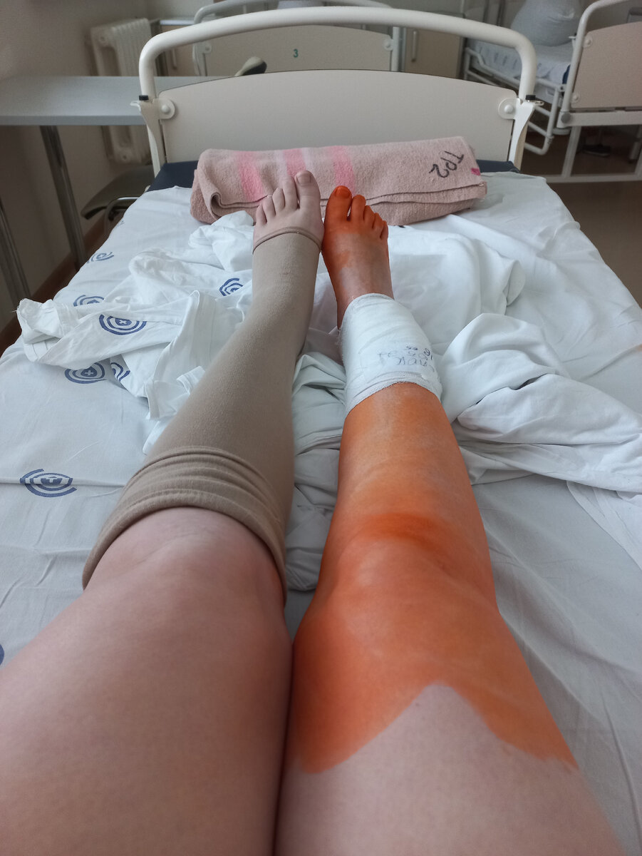 Моя красивая нога, одна и вторая )))