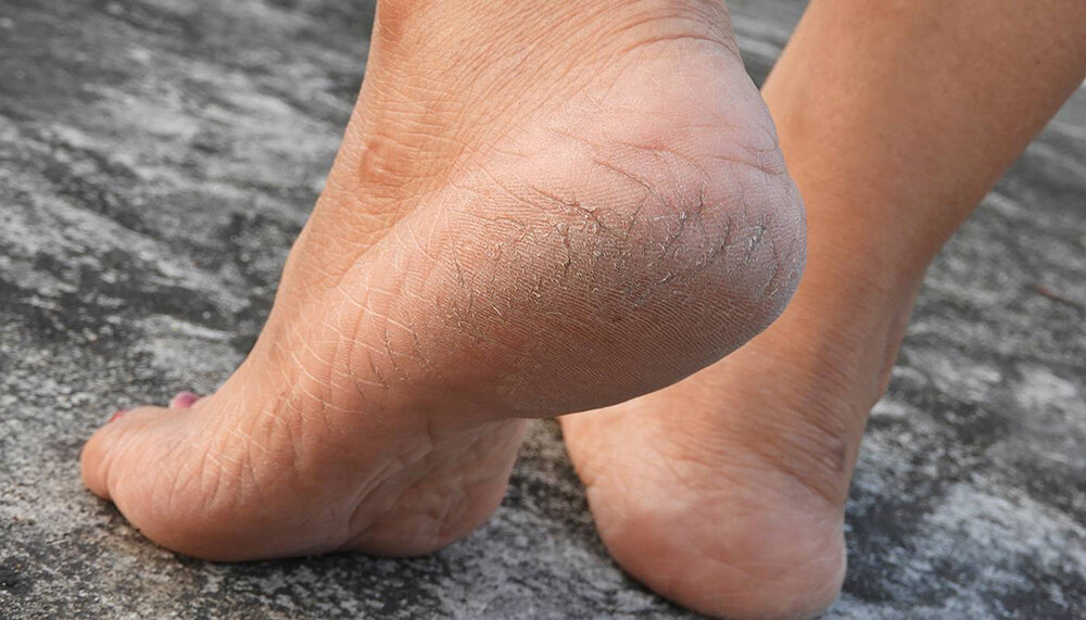 Фото из открытых источников Яндекс