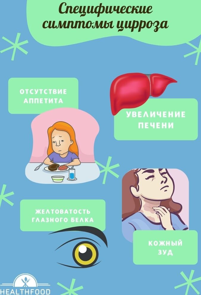Специфические симптомы цирроза