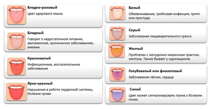 Налет на языке о чем говорит таблица