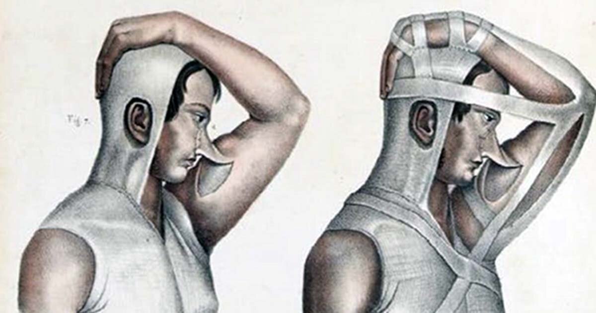 Чел 18 1. Пластические операции в средневековье. Пластическая хирургия 19 века. Пластическая хирургия средневековье. Пластическая хирургия в древности