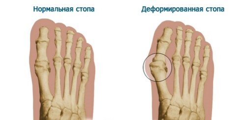 Фиксаторы пальцев купить в Ижевске в интернет магазине ДомДоктор