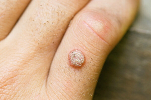 Источник: https://yandex.ru/images