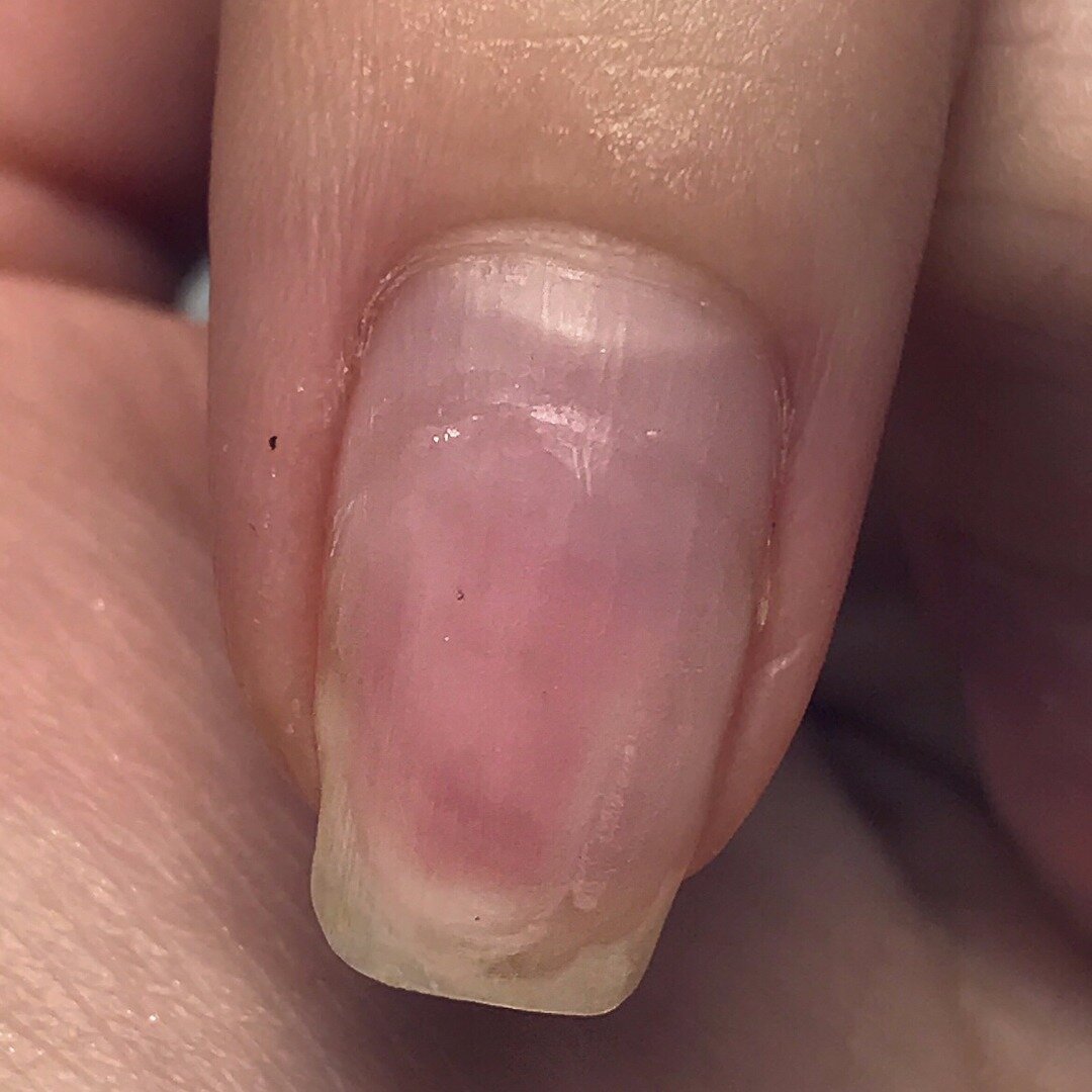 Вот такая картина вырисовывается