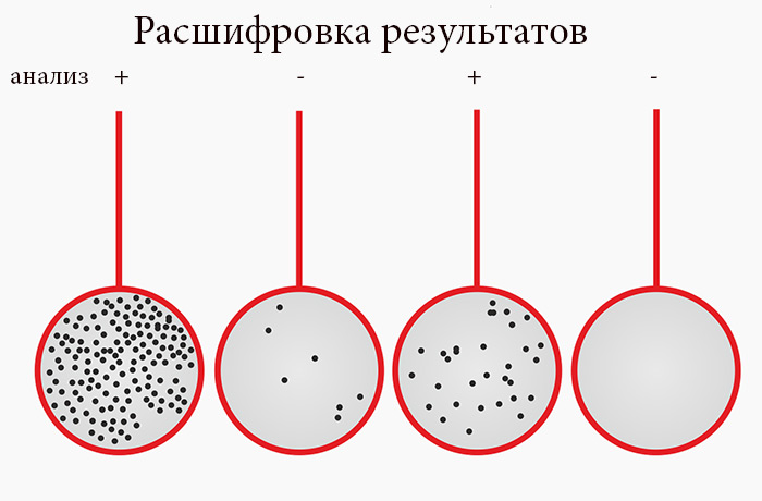 T-spot.TB тест. T-spot тест и квантиферон-тест. Т спот. Тест т-спот для диагностики туберкулеза.