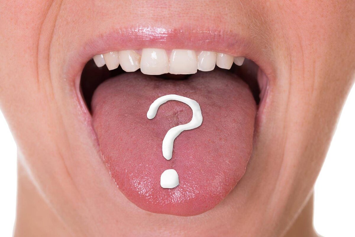 Налёт ня языке - не болезнь, а симптом. Почему он образуется? И когда это является тревожным признаком? На эти вопросы нам отвечает наш врач-стоматолог: Елена Хотянович.