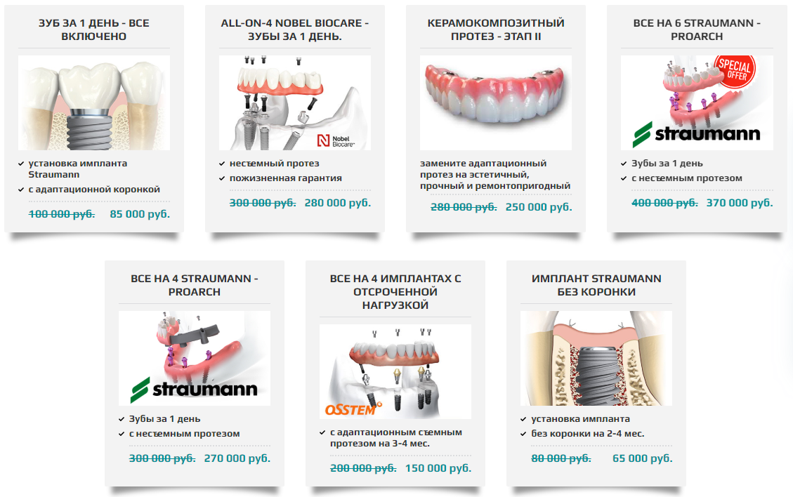 Все об имплантации зубов подробно в деталях с наглядными картинками