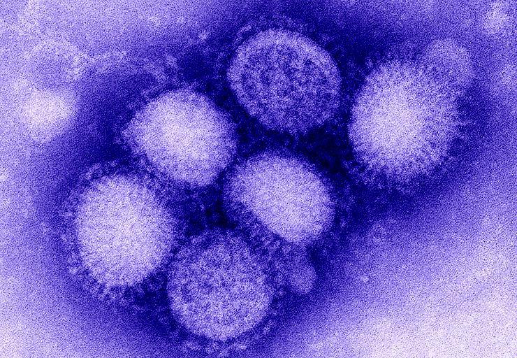 Изображение вируса «свиного» гриппа (H1N1) из лаборатории CDC