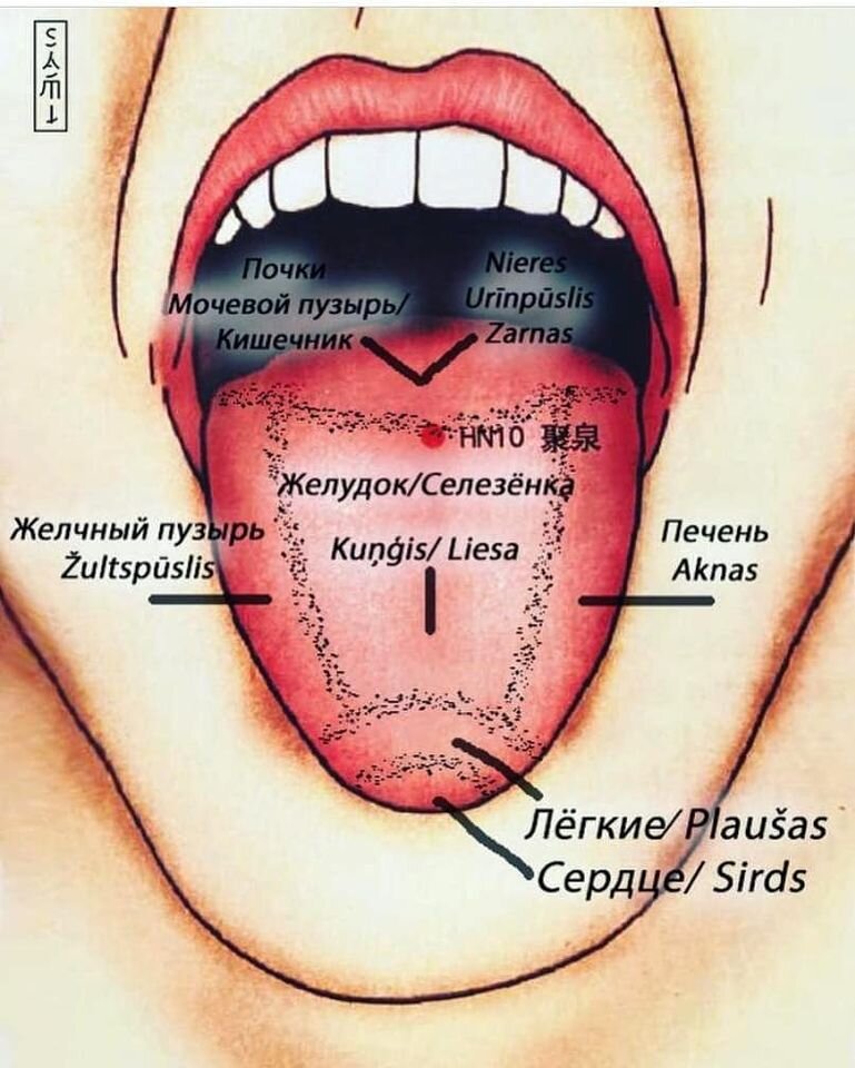 ☝️Если вы покажете свой язык👅 специалисту по Традиционной китайской медицине, то он очень много сможет вам рассказать о вашем организме. ⠀
Осмотр языка - это один из методов диагностики #ТКМ. Язык👅 - это миниатюрная карта нашего организма. Разные его части - это минипроекции наших внутренних органов.
⠀
➡️Специалист обязательно обратит внимание на форму языка, его цвет, цвет и характер налёта, наличие пузырьков, папиллом и т.д.
⠀
‼️Любые отклонения от нормальных показателей расскажут нашим специалистам о различных заболеваниях.
⠀
👉Мы хотим предложить вам БЕСПЛАТНУЮ ДИСТАНЦИОННУЮ ДИАГНОСТИКУ по ЯЗЫКУ. Для этого вам нужно его сфотографировать📸 при хорошем освещении и прислать фотографию нам.
⠀
Самое важное для человека - это ЗДОРОВЬЕ.  И, особенно сейчас, мы готовы помочь вам в его укреплении дистанционно.  Нам всегда приятно, когда вы перестаёте чувствовать болезнь и позволяете себе жить  полноценной жизнью.
⠀
❗️Как отправить фото ❓
⠀
⛩ Напишите в комментариях под этим постом слово #диагностика
⛩ Отправьте нам фото 👅 в Direct
⛩ WhatsApp / WA business +371 28 444 656
⛩ Facebook/ Messenger
⠀
И мы свяжемся с вами в ближайшее время!
⠀
Наши специалисты смогут оценить состояние Вашего здоровья и дать свои рекомендации.
Ваш #SAMI❤